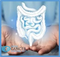 Top  Surgeons for Colon Cancer Treatment India