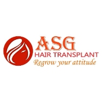 ASG Hair Transplant - Hair Transplant in Punjab