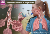 Asthma Problem in Rajasthan - Nishant Allergy and E.N.T Clinic