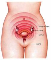 Menstrual Cramps | NYC Dysmenorrhea Specialist, Doctor | Gynecologist Midtown Manhattan NYC