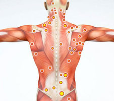 Trigger Point Injections in NYC | Pain Management Doctors Specialists