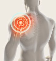 Stem Cell Therapy Shoulder and Rotator Cuff Injuries Treatment