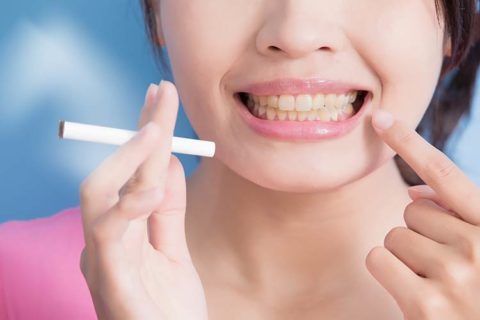 How Bad Is Smoking for Your Teeth?